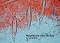 Hohenbuehelia myxotricha-amf2018-cystides